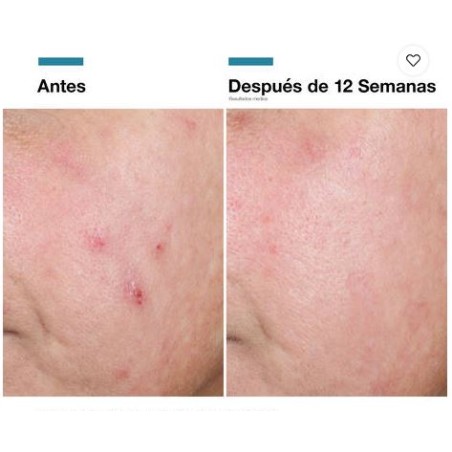 Skinceuticals Advance RGN-6 50ml